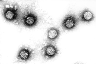 فيروس الورم الحليمي البشري